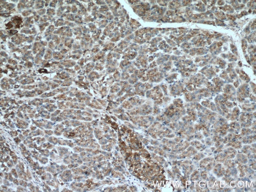 [14367-1-AP-20UL] GAA Polyclonal antibody
