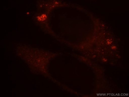 [14368-1-AP-150UL] BPI Polyclonal antibody