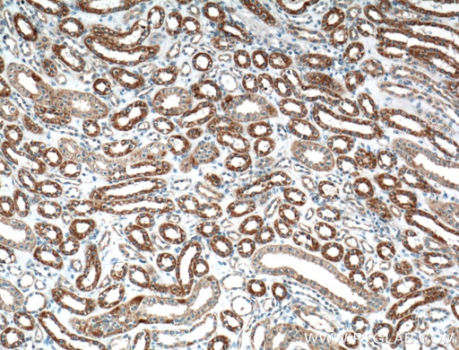 [14371-1-AP-20UL] WNT4 Polyclonal antibody