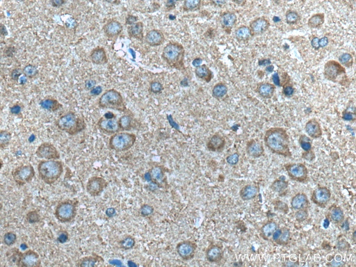 [14373-1-AP-20UL] NTM Polyclonal antibody