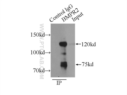 [14376-1-AP-150UL] BMPR2 Polyclonal antibody