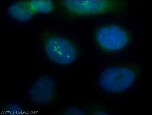 [14377-1-AP-20UL] PSMA2 Polyclonal antibody