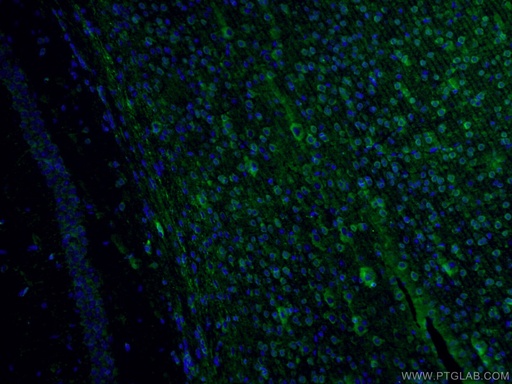 [14384-1-AP-150UL] Fascin Polyclonal antibody