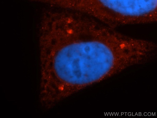 [14388-1-AP-20UL] Casein Kinase 1 Delta Polyclonal antibody