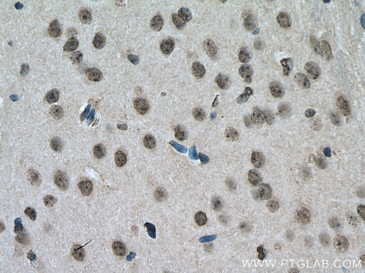 [14392-1-AP-20UL] YTHDC1 Polyclonal antibody