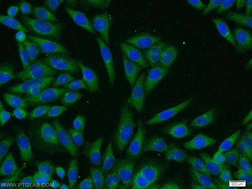 [14396-1-AP-20UL] PASK Polyclonal antibody