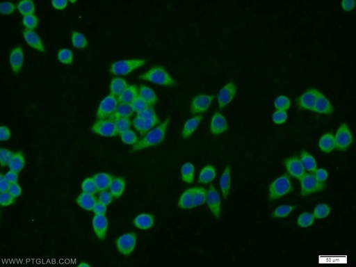 [14397-1-AP-150UL] SCP2/SCPx Polyclonal antibody
