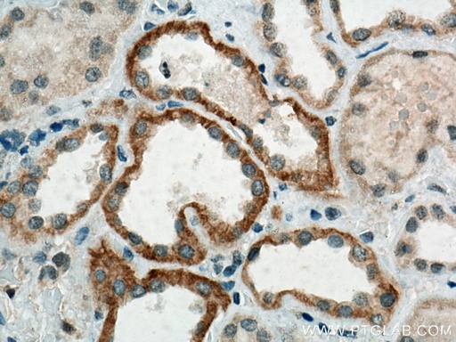 [14402-1-AP-20UL] CLCNKA Polyclonal antibody