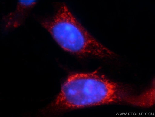[14404-1-AP-150UL] TRAF3IP1 Polyclonal antibody