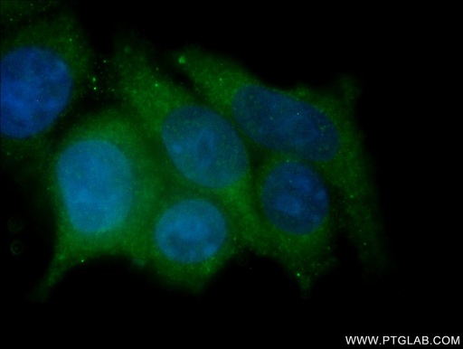 [14406-1-AP-150UL] HE4 Polyclonal antibody