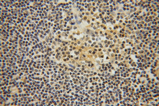 [14407-1-AP-20UL] ITM2A Polyclonal antibody