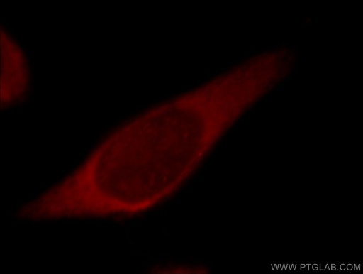 [14413-1-AP-20UL] PIBF1 Polyclonal antibody