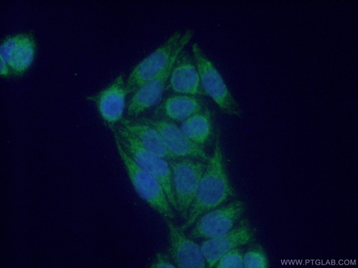 [14417-1-AP-150UL] NDUFS6 Polyclonal antibody