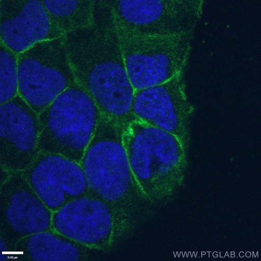 [14418-1-AP-150UL] ATP1A1 Polyclonal antibody