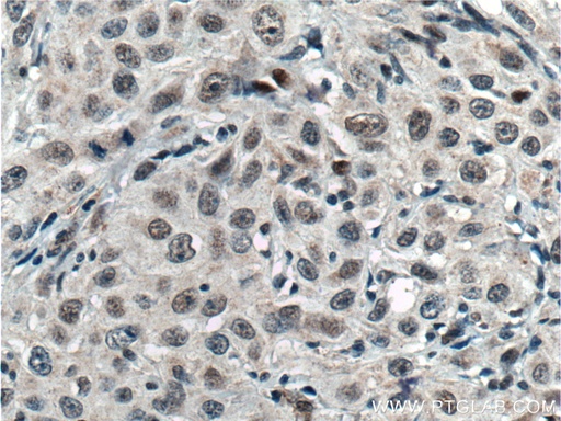[14419-1-AP-20UL] TCF12/HEB Polyclonal antibody