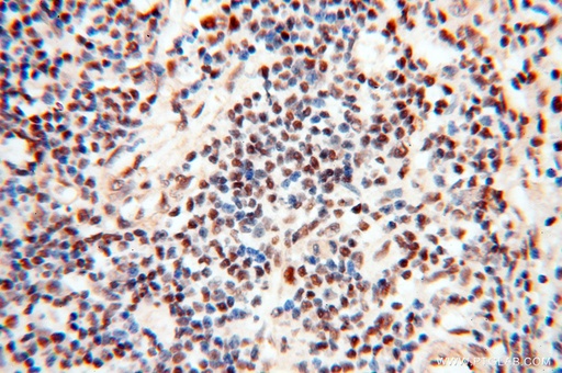 [14421-1-AP-20UL] TIMELESS Polyclonal antibody