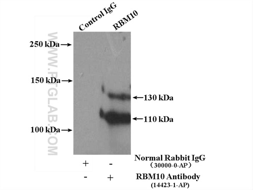 [14423-1-AP-150UL] RBM10 Polyclonal antibody