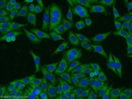 [14424-1-AP-150UL] TAX1BP1 Polyclonal antibody
