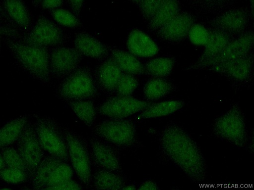 [14426-1-AP-20UL] KDM5C Polyclonal antibody
