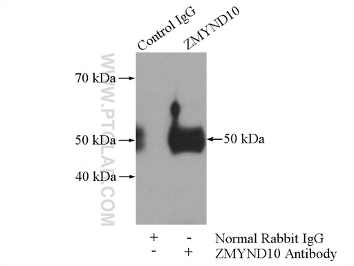 [14431-1-AP-150UL] ZMYND10 Polyclonal antibody