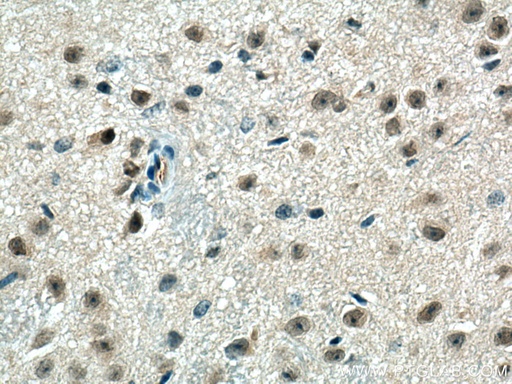 [14435-1-AP-150UL] PPME1 Polyclonal antibody