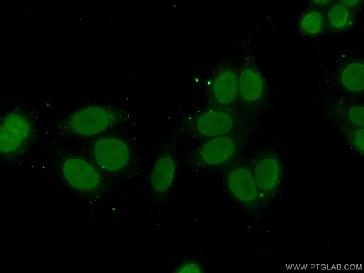 [14436-1-AP-20UL] TFIP11 Polyclonal antibody