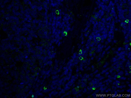 [14437-1-AP-150UL] TMPRSS2 Polyclonal antibody