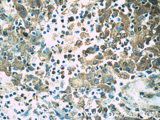 [14443-1-AP-150UL] ORAI1 Polyclonal antibody