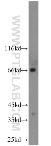 [14450-1-AP-150UL] TSHR Polyclonal antibody