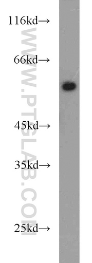 [14452-1-AP-150UL] PLVAP Polyclonal antibody