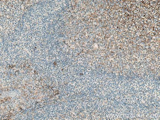 [14453-1-AP-20UL] B7-H3 Polyclonal antibody