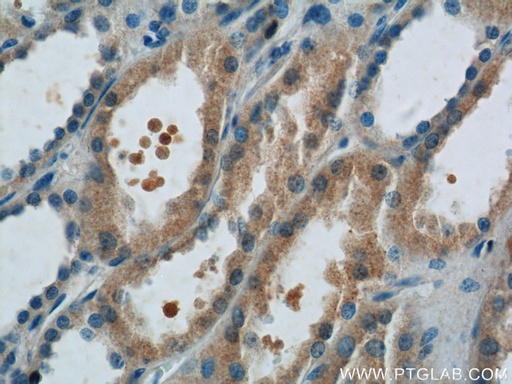 [14454-1-AP-20UL] FANCL Polyclonal antibody