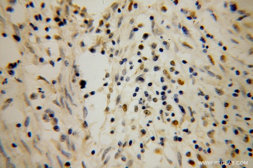 [14455-1-AP-150UL] POLK Polyclonal antibody