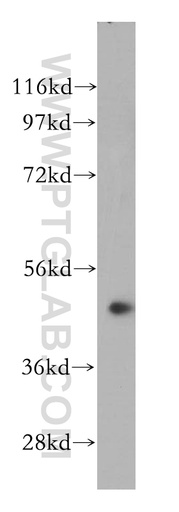[14456-1-AP-20UL] NOB1 Polyclonal antibody