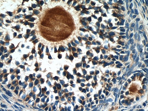 [14461-1-AP-150UL] AMH Polyclonal antibody