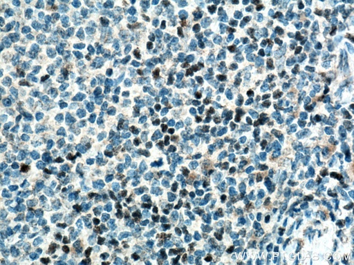[14464-1-AP-20UL] TCF7 Polyclonal antibody