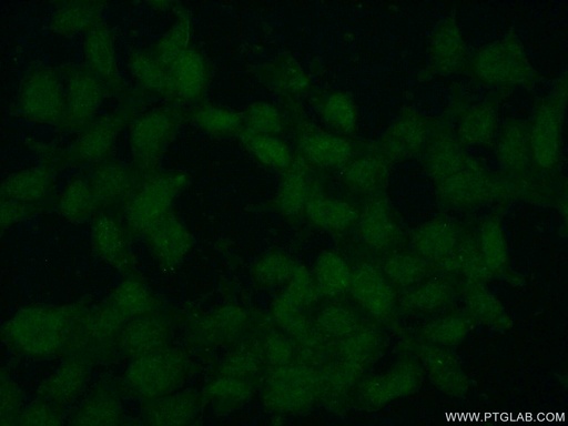[14465-1-AP-150UL] SMC6 Polyclonal antibody