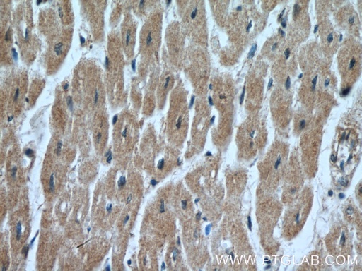 [14466-1-AP-20UL] FECH Polyclonal antibody