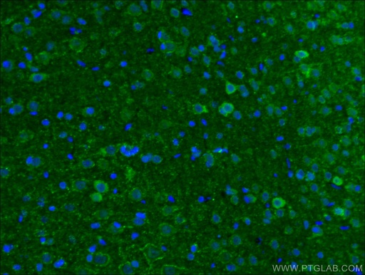 [14471-1-AP-20UL] VGAT Polyclonal antibody