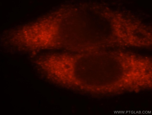 [14475-1-AP-150UL] GSTA1 Polyclonal antibody