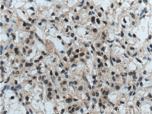 [14480-1-AP-150UL] TFE3 Polyclonal antibody