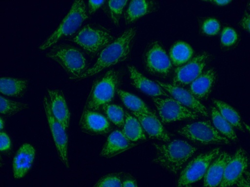 [14487-1-AP-150UL] PNPT1 Polyclonal antibody