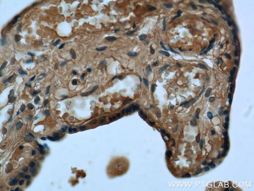 [14491-1-AP-20UL] RPS7 Polyclonal antibody