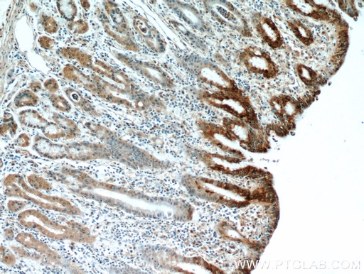 [14494-1-AP-150UL] Gastrokine 1 Polyclonal antibody