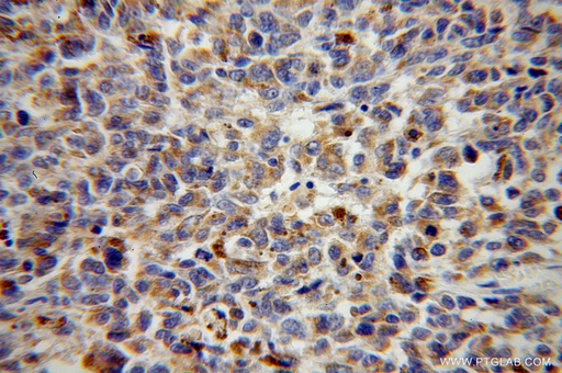[14495-1-AP-150UL] VTI1B Polyclonal antibody