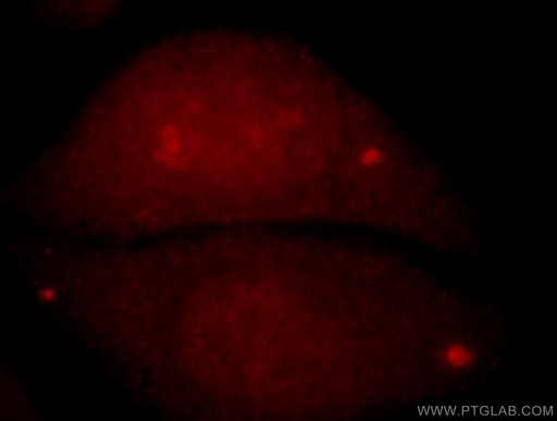 [14496-1-AP-20UL] C9orf78 Polyclonal antibody