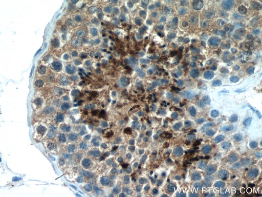 [14500-1-AP-20UL] PRM2 Polyclonal antibody