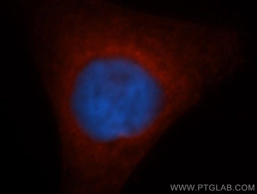 [14502-1-AP-20UL] GSTM5 Polyclonal antibody