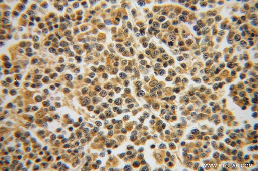 [14505-1-AP-20UL] GRAP Polyclonal antibody