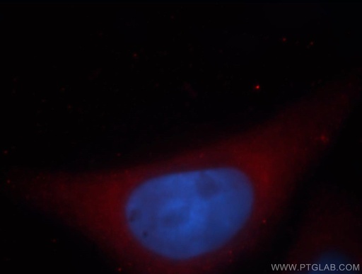 [14509-1-AP-20UL] UBL4B Polyclonal antibody